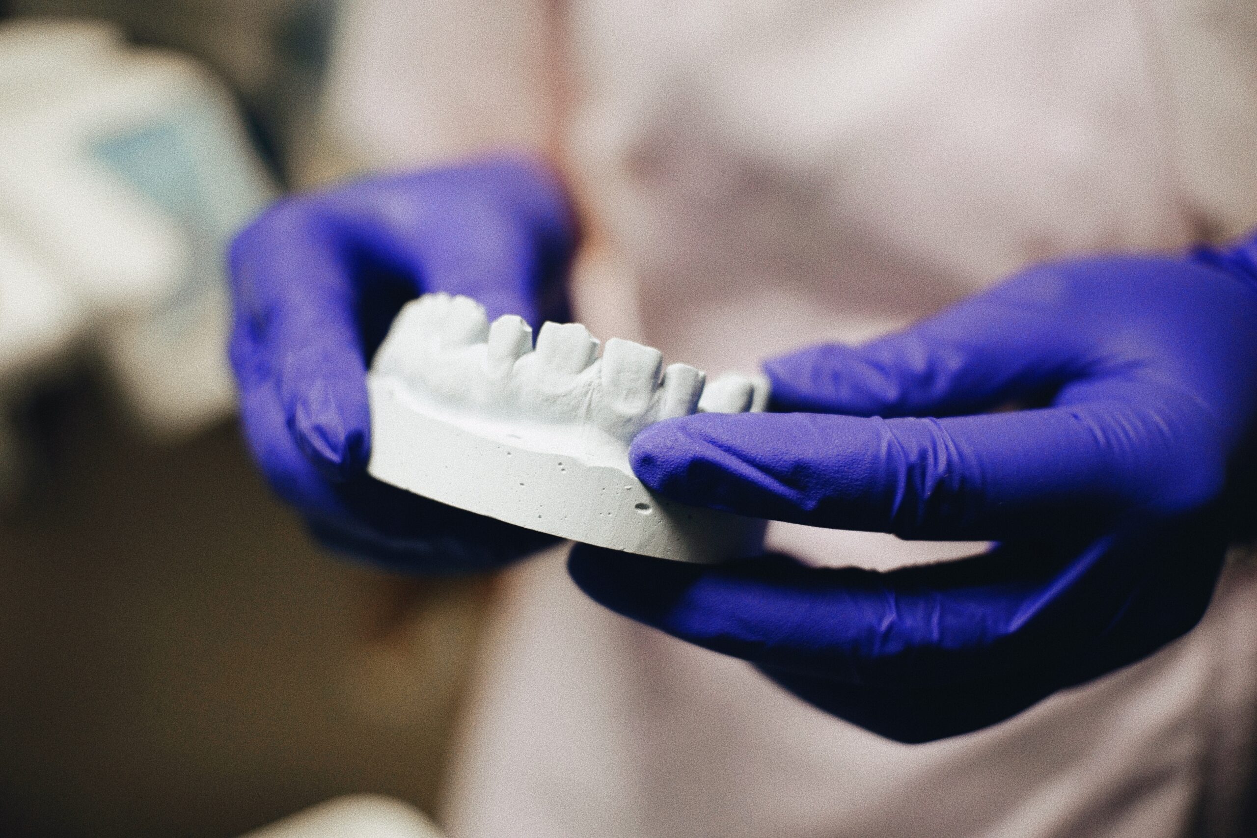 what is composite bonding