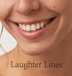 Laughter-Lines-with-type
